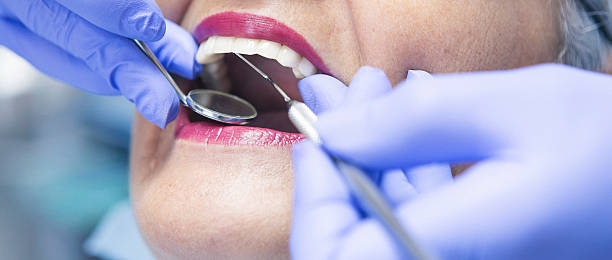 Best Weekend Emergency Dentist in White Marsh, MD