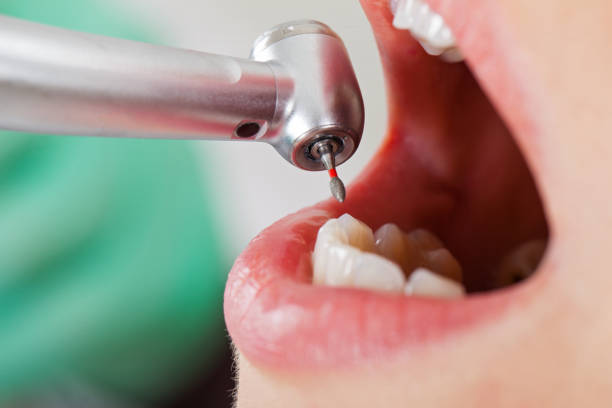 Best Emergency Dental Services for Seniors in White Marsh, MD